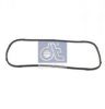 DT 2.11020 Gasket, housing cover (crankcase)